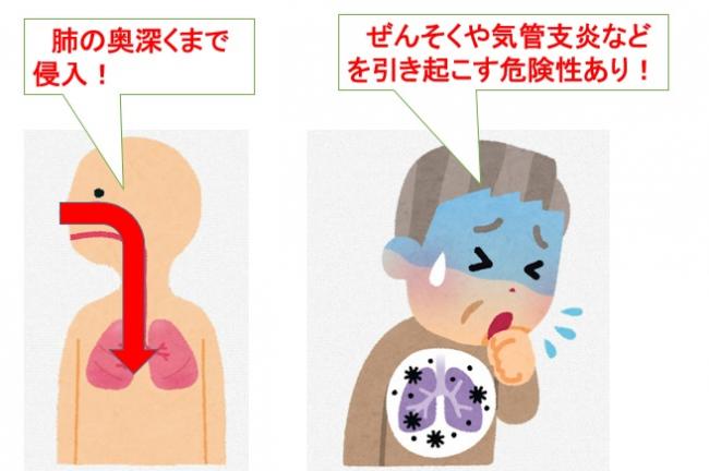 PM2.5の健康影響について図示したものです。