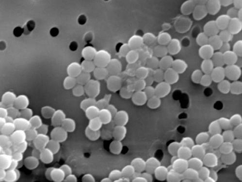 電子顕微鏡による黄色ブドウ球菌の写真です。