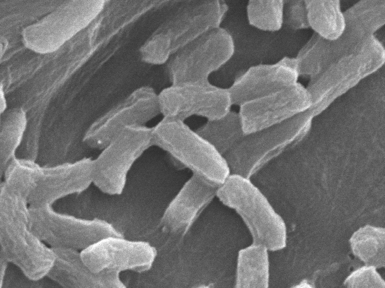 サルモネラ属菌の電子顕微鏡写真です。